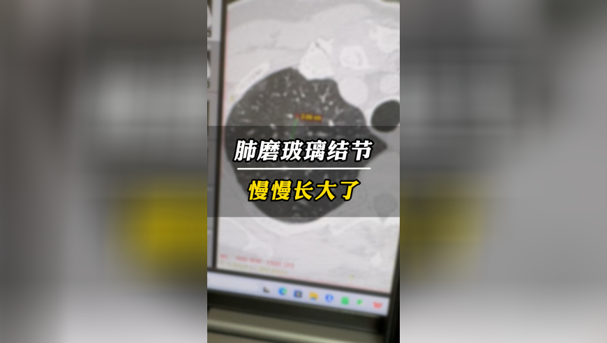 天天彩二四六(944)246,刘强东：克扣五险一金是耻辱的,动态词语解释落实_至尊版V6.78